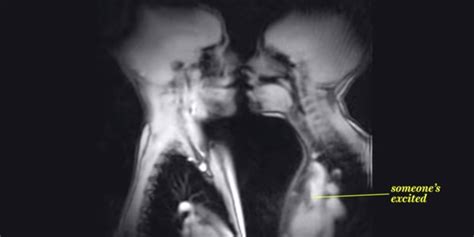 porn xray|X Ray Penetration Porn Videos .